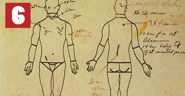 jfk-conspiracy-autopsy